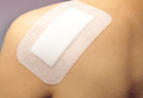 Wound_dressing